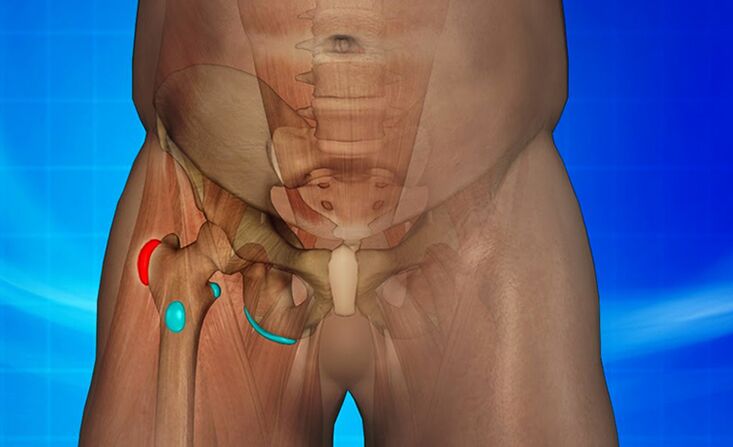 hip joint inflammation as a cause of pain